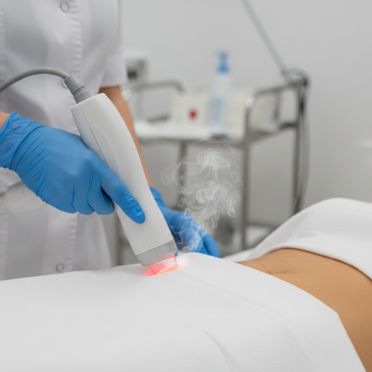 Vagina Laser Treatment