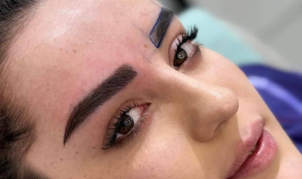 Eyebrow Transplant