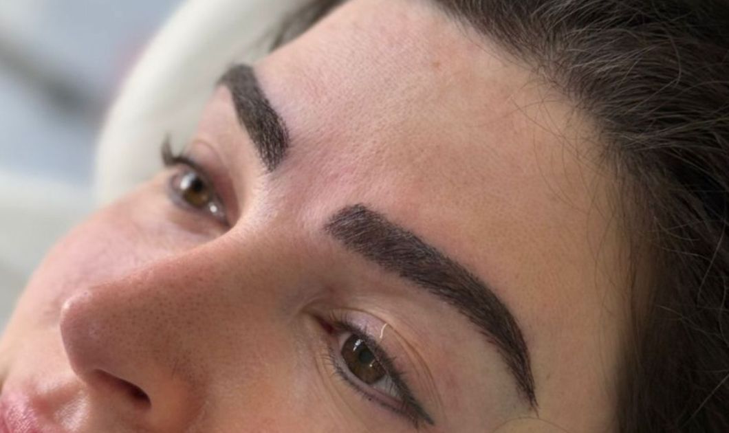 Eyebrows Transplant