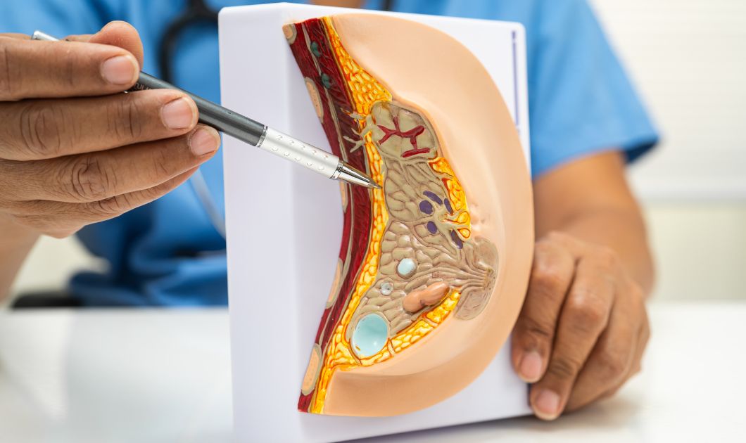 Mia Femtech Breast Augmentation In Dubai