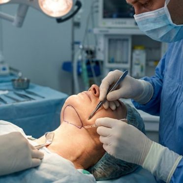 Neck Lift (Platysmaplasty)