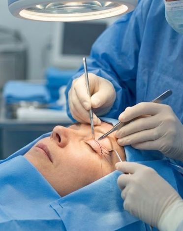 Upper Eyelid Blepharoplasty