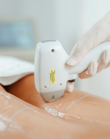 CO2 Laser Gynecology