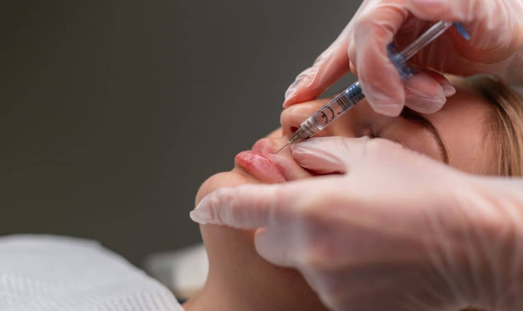 Derma Lip Filler injection