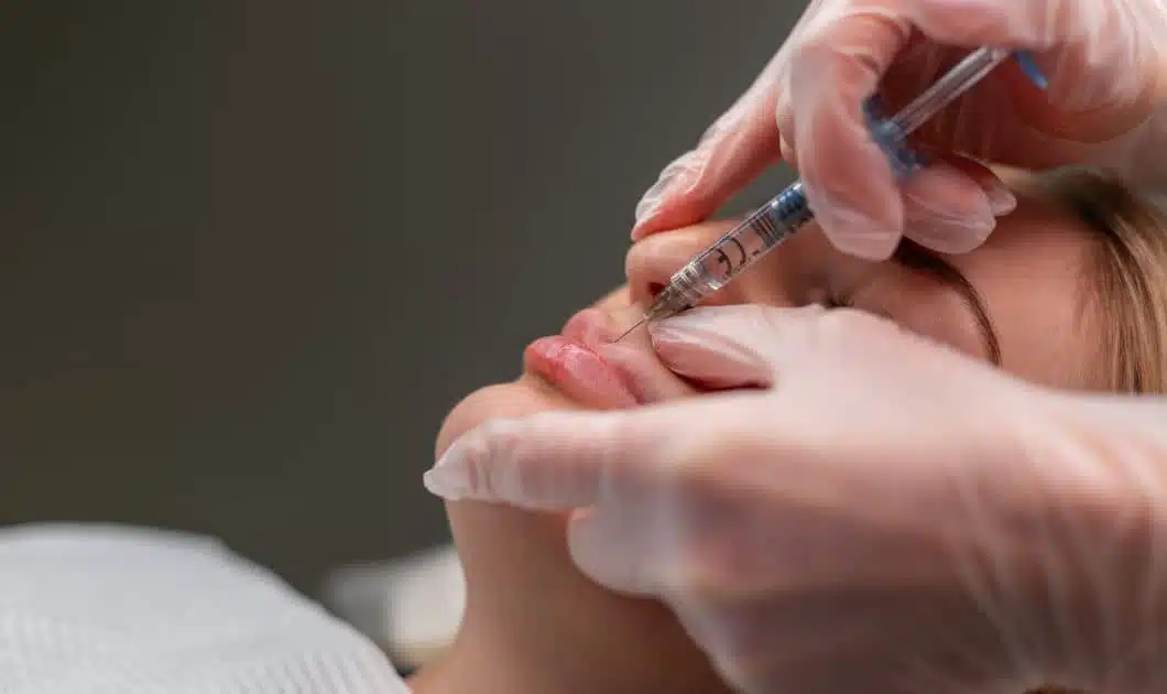 Derma Lip Filler injection