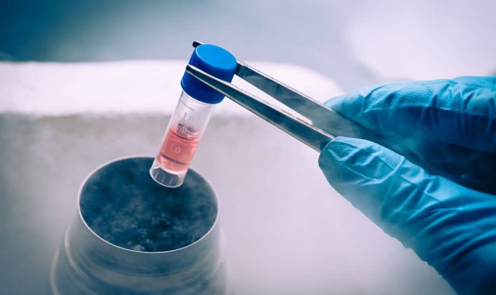 Stem Cell Therapy in Dubai