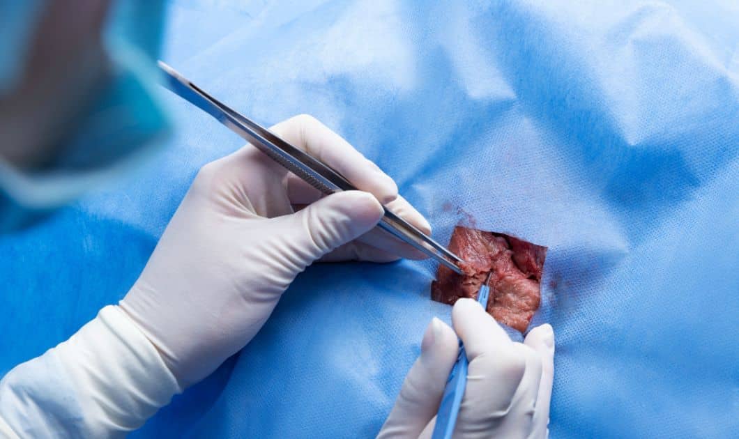 Best Labiaplasty Surgery in Dubai