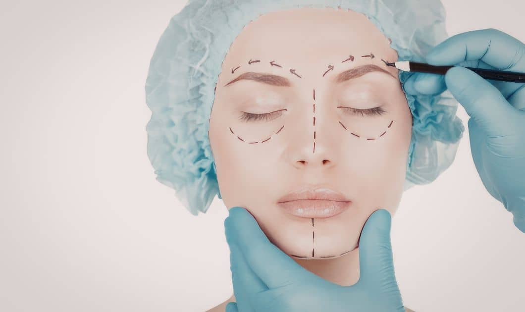 Full Face Transformation with Surgery in Dubai