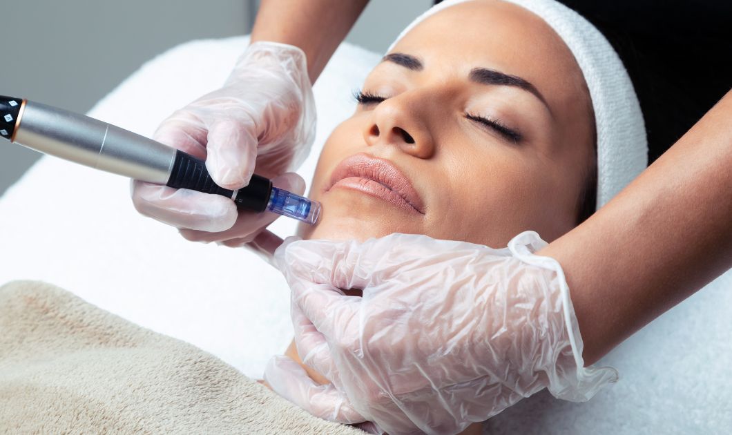 Mesotherapy treatment in Dubai