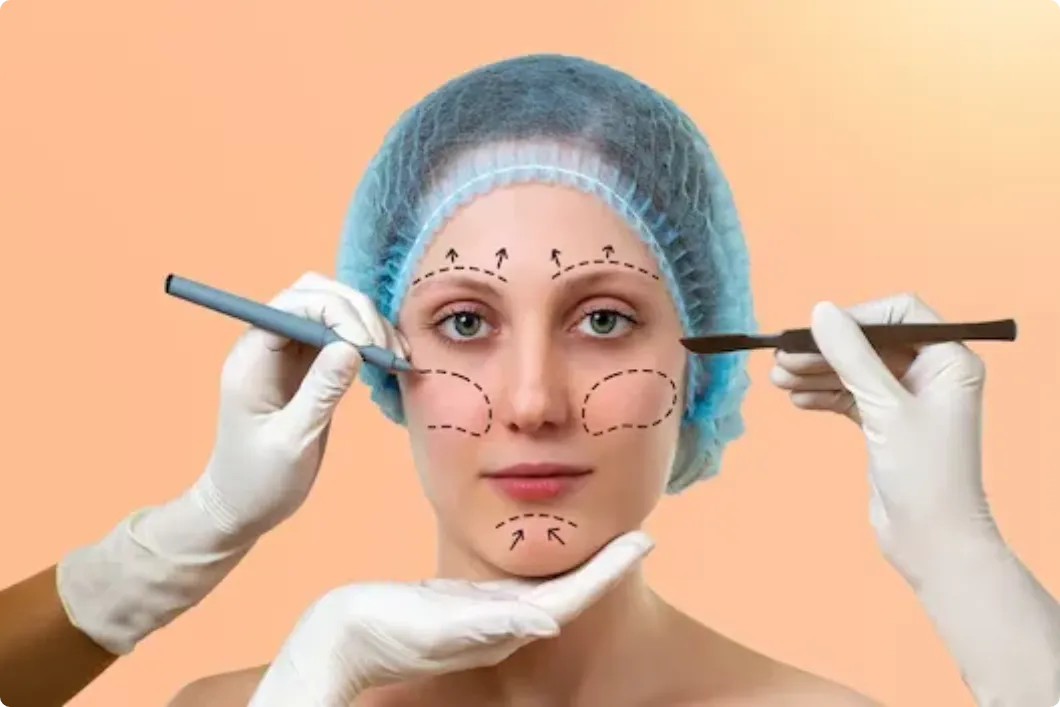 Facelift Recovery Timeline