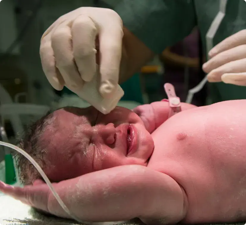 Newborn Initial Care