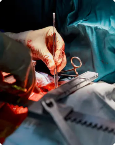 Recovery After an Emergency Cesarean Section