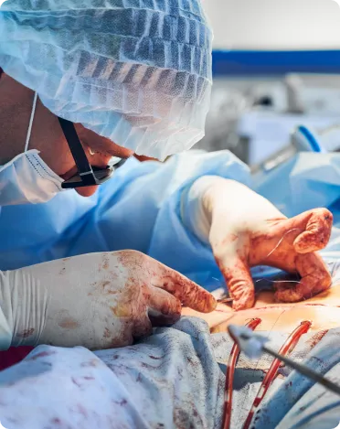 Timing of a Repeat Cesarean Section