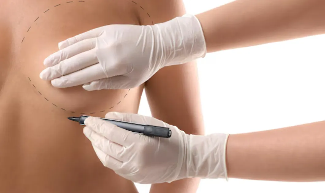 breast lift dubai