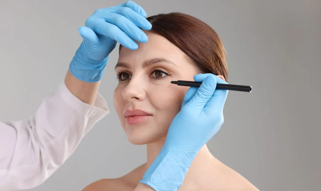 what is a facelift