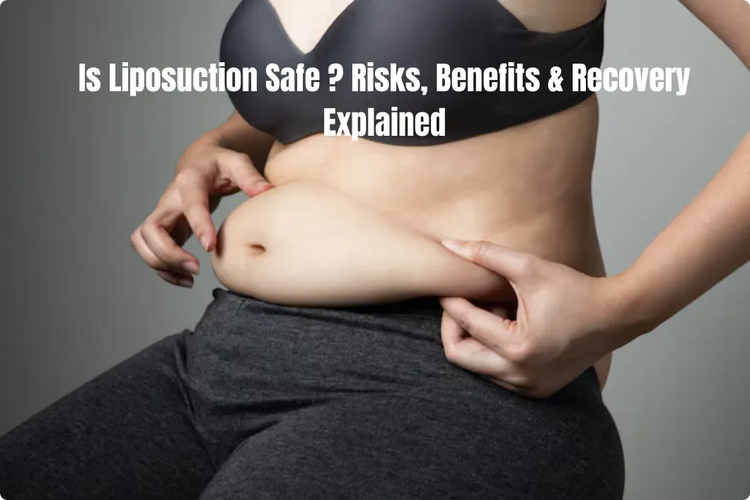is liposuction safe