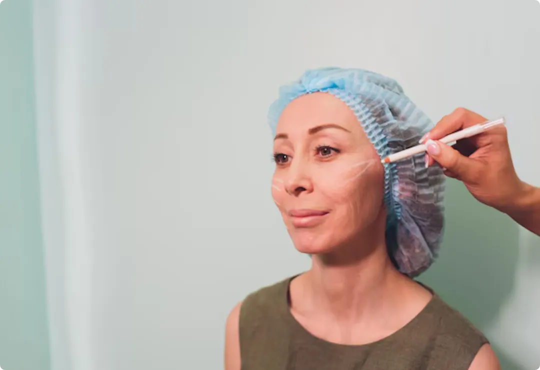 Mono Thread Lift Recovery