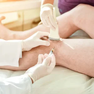 Benefits of PRP for Knee Pain