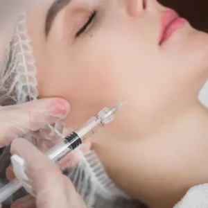 Benefits of Profhilo Treatment