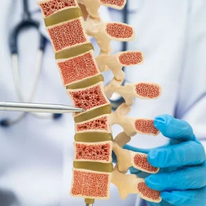Bone density treatment