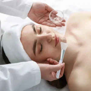 Chemical Peel for Fine Lines