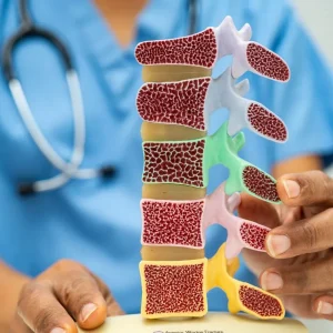 Common Osteoporosis Symptoms