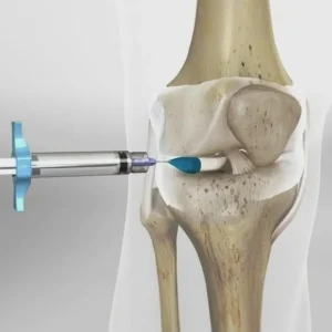 Cortisone Injections for Joint Pain