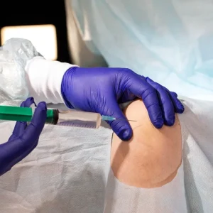 Cortisone shot for knee arthritis