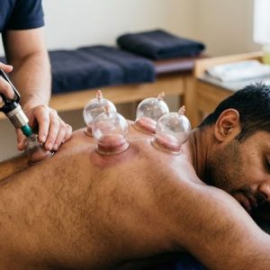 Dry Cupping Therapy