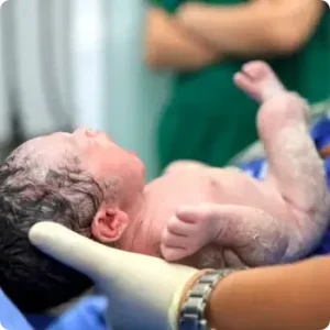 Epidural Delivery Support