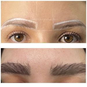 Natural eyebrow transplant Dubai results showing full brow density