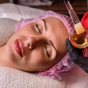 Karisma treatment