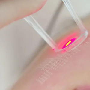 Laser skin rejuvenation