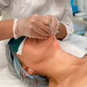 Laser skin tightening Dubai