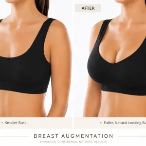 Mastopexy in Dubai
