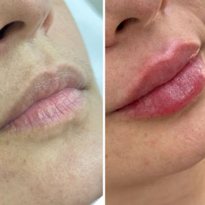 Microblading Lips before and after pigmentation results