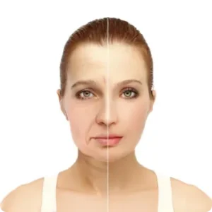 Mini Face Lift vs Full Facelift
