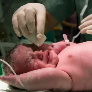 Newborn Initial Care
