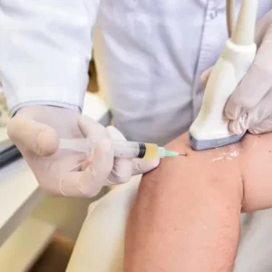 PRP for Knee Pain in Dubai
