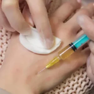 PRP for Wrist Pain in Dubai