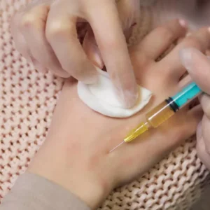 PRP injection for wrist pain