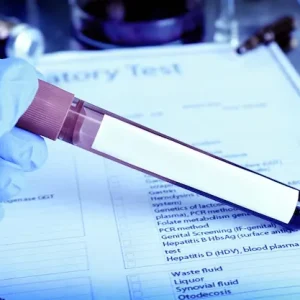 Private STI Testing in Dubai