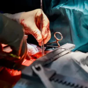 Recovery After an Emergency Cesarean Section