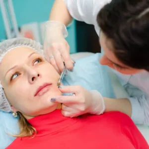 Sculptra Treatment