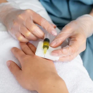 Stem Cell Therapy for Wrist Pain