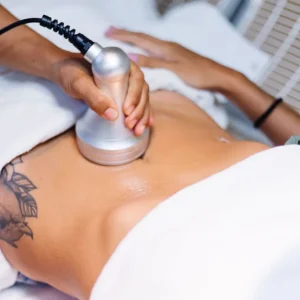 Venus Legacy treatment