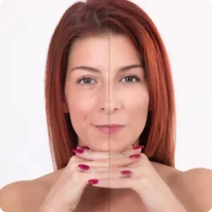 before after