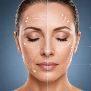 ozone therapy treatment Before & After Results