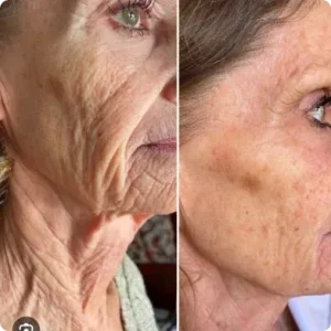 results after tissue regeneration therapy
